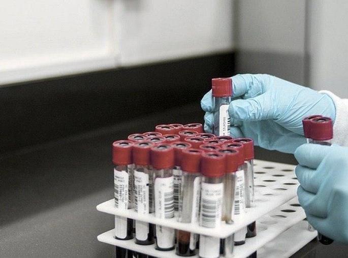 coronavirus: Addition of six corona infected patients in Jalna district | coronavirus : जालना जिल्ह्यात सहा बाधित रूग्णांची भर