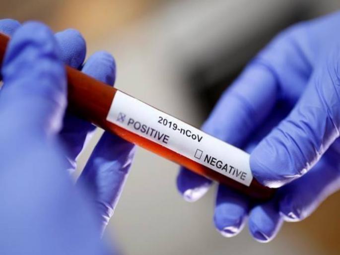 Corona Virus: 872 new patients in Pimpri-Chinchwad, 16 died | Corona Virus : पिंपरी-चिंचवड शहरात नवे ८७२ रुग्ण, १६ जणांचा मृत्यू