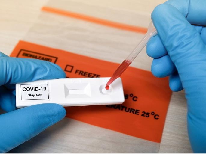 Coronavirus In Aurangabad : The city will now have antibody tests; Municipality planning started | Coronavirus In Aurangabad : शहरात आता अँटिबॉडी टेस्ट होणार; महापालिकेचे नियोजन सुरू Coronavirus In Aurangabad : The city will now have antibody tests; Municipality planning started | Coronavirus In Aurangabad : शहरात आता अँटिबॉडी टेस्ट होणार; महापालिकेचे नियोजन सुरू
