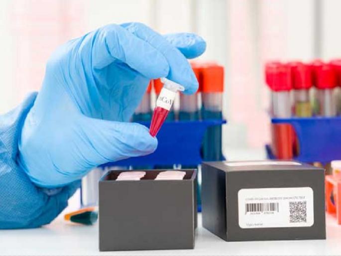 Aurangabad district saw an increase of 95 patients on Tuesday, with 66 patients on leave | औरंगाबाद जिल्ह्यात मंगळवारी ९५ रुग्णांची वाढ, ६६ रुग्णांना सुटी Aurangabad district saw an increase of 95 patients on Tuesday, with 66 patients on leave | औरंगाबाद जिल्ह्यात मंगळवारी ९५ रुग्णांची वाढ, ६६ रुग्णांना सुटी