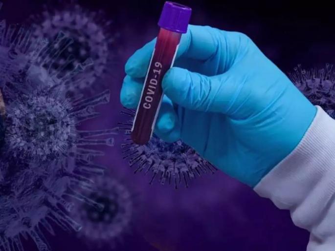 Corona Virus In Aurangabad: An increase of 39 corona viruses cases in the district; Total number of patients 9104 | CoronaVirus In Aurangabad : जिल्ह्यात ३९ कोरोनाबाधितांची वाढ; एकूण रुग्णसंख्या ९१०४ Corona Virus In Aurangabad: An increase of 39 corona viruses cases in the district; Total number of patients 9104 | CoronaVirus In Aurangabad : जिल्ह्यात ३९ कोरोनाबाधितांची वाढ; एकूण रुग्णसंख्या ९१०४