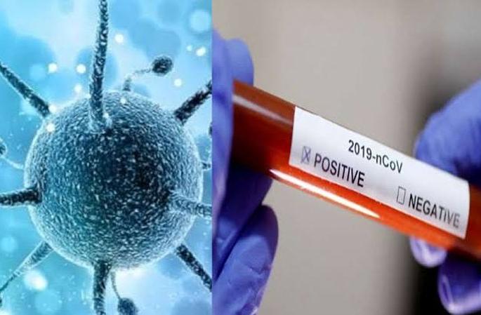 Corona eruption in Buldana district after unlock | अनलॉकनंतर बुलडाणा जिल्ह्यात कोरोनाचा उद्रेक Corona eruption in Buldana district after unlock | अनलॉकनंतर बुलडाणा जिल्ह्यात कोरोनाचा उद्रेक