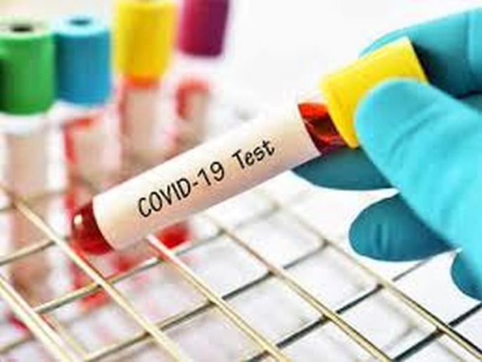 Corona cases in Akola: Only one positive in 449 tests | Coronavirus: महाराष्ट्रातील या जिल्ह्यात कोरोनाची लाट पूर्णपणे नियंत्रणात, दिवसभरात सापडला केवळ एक रुग्ण Corona cases in Akola: Only one positive in 449 tests | Coronavirus: महाराष्ट्रातील या जिल्ह्यात कोरोनाची लाट पूर्णपणे नियंत्रणात, दिवसभरात सापडला केवळ एक रुग्ण