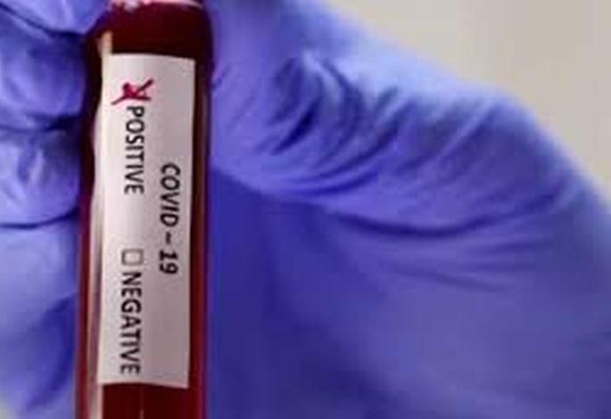 Corona Cases in Akola: 6 killed, 408 positive, 615 corona overcome | Corona Cases in Akola : सहा जणांचा मृत्यू : ४०८ पॉझिटिव्ह, तर ६१५ जणांची कोरोनावर मात