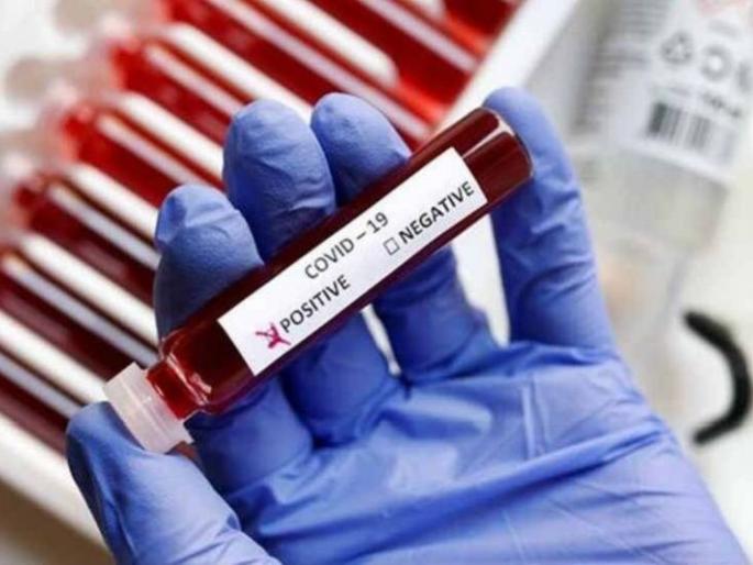 Corona Cases in Akola: Death of both, nine corona positive | Corona Cases in Akola : दोघांचा मृत्यू, नऊ कोरोना पॉझिटिव्ह Corona Cases in Akola: Death of both, nine corona positive | Corona Cases in Akola : दोघांचा मृत्यू, नऊ कोरोना पॉझिटिव्ह