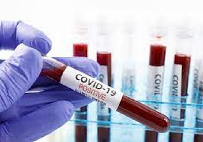 Corona Cases in Akola: Another death, 10 positive | Corona Cases in Akola : आणखी एकाचा मृत्यू, १० पॉझिटिव्ह Corona Cases in Akola: Another death, 10 positive | Corona Cases in Akola : आणखी एकाचा मृत्यू, १० पॉझिटिव्ह