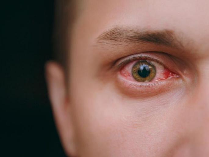 Covid infection through eye: Take special care of the eyes | कोविडचा डोळ्यातूनही संसर्ग : डोळ्यांची विशेष काळजी घ्या