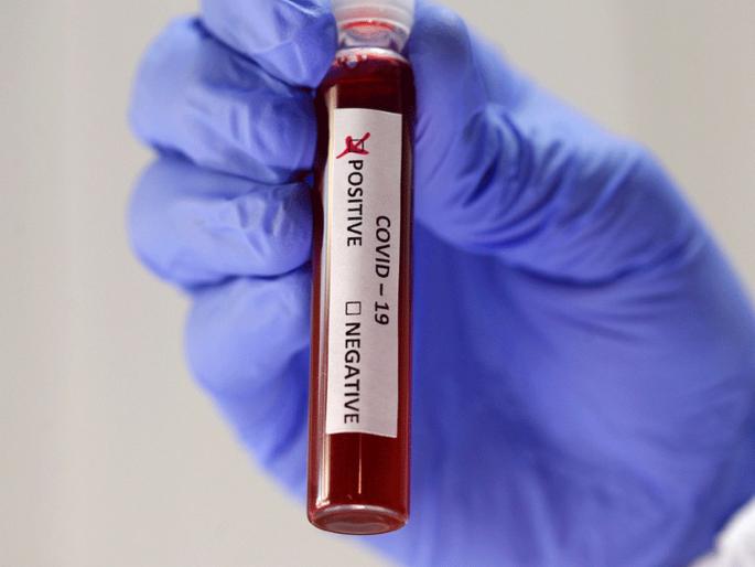 CoronaVirus marathi News dialysis center in mira roads indira gandhi hospital closed after one found covid positive kkg | CoronaVirus News: डायलिसिस करून गेलेल्या 'त्या' रुग्णाचा कोरोना रिपोर्ट पॉझिटिव्ह; प्रसुती रुग्णालयात खळबळ