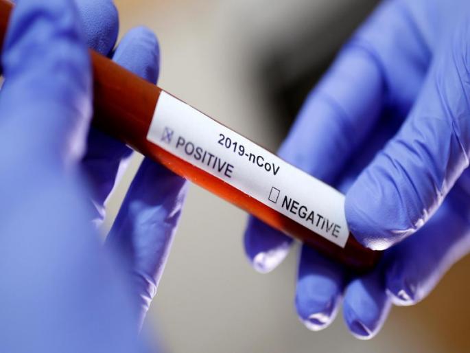 Corona virus : 14th Corona positive patient found in Baramati, Kalyaninagar seal in MIDC | Corona virus : बारामतीत सापडला १४ वा कोरोना पॉझिटीव्ह रुग्ण, एमआयडीसीतील कल्याणीनगर सील Corona virus : 14th Corona positive patient found in Baramati, Kalyaninagar seal in MIDC | Corona virus : बारामतीत सापडला १४ वा कोरोना पॉझिटीव्ह रुग्ण, एमआयडीसीतील कल्याणीनगर सील