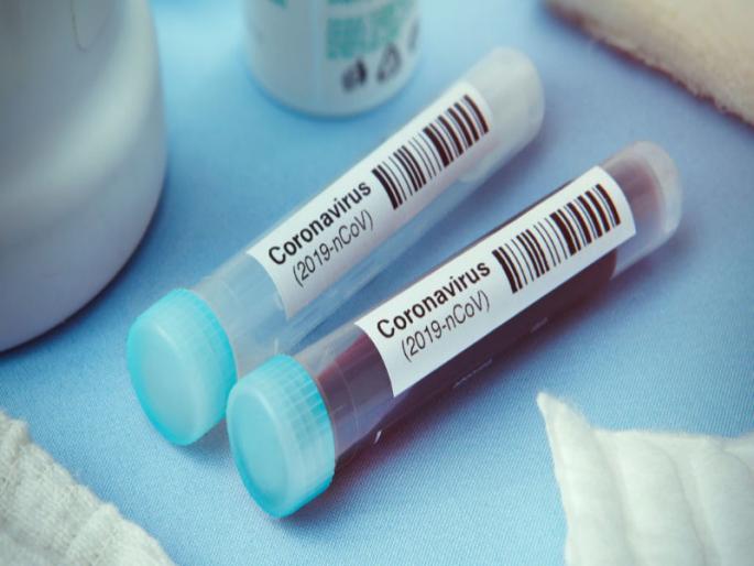 Corona virus : The highest ever increase of 1812 patients in Pune city; total number on 31thousand 884 | Corona virus : चिंताजनक ! पुणे शहरात गुरुवारी आजवरची सर्वाधिक १८१२ कोरोना रूग्णांची वाढ; एकूण संख्या ३१ हजार ८८४ Corona virus : The highest ever increase of 1812 patients in Pune city; total number on 31thousand 884 | Corona virus : चिंताजनक ! पुणे शहरात गुरुवारी आजवरची सर्वाधिक १८१२ कोरोना रूग्णांची वाढ; एकूण संख्या ३१ हजार ८८४