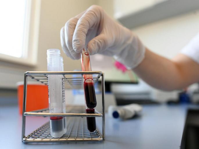coronavirus: Relief ! Plasma therapy started on corona patients at Ghati Hospital, Aurangabad | coronavirus : दिलासादायक ! औरंगाबादच्या घाटी रुग्णालयात प्लाझ्मा थेरपीला सुरुवात coronavirus: Relief ! Plasma therapy started on corona patients at Ghati Hospital, Aurangabad | coronavirus : दिलासादायक ! औरंगाबादच्या घाटी रुग्णालयात प्लाझ्मा थेरपीला सुरुवात