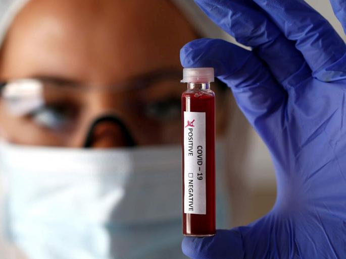 corona virus : Contact tracing; There is no record of 3 million corona victims in the state | corona virus : कॉन्टॅक्ट ट्रेसिंग; राज्यात ३० लाख कोरोनाबाधितांच्या सहवासितांची नोंदच नाही corona virus : Contact tracing; There is no record of 3 million corona victims in the state | corona virus : कॉन्टॅक्ट ट्रेसिंग; राज्यात ३० लाख कोरोनाबाधितांच्या सहवासितांची नोंदच नाही