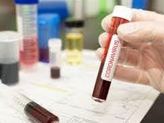 On the second day of discharge young man was again tested positive for coronavirus | CoronaVirus News: अरे बापरे! डिस्चार्ज मिळाल्याच्या दुसऱ्या दिवशी तरुण पुन्हा पॉझिटिव्ह On the second day of discharge young man was again tested positive for coronavirus | CoronaVirus News: अरे बापरे! डिस्चार्ज मिळाल्याच्या दुसऱ्या दिवशी तरुण पुन्हा पॉझिटिव्ह