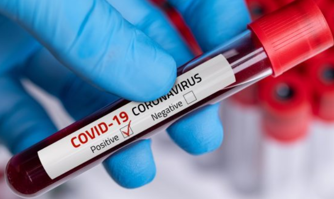 Corona virus : 1 thousand 159 corona free in Pune city on Wednesday; Addition of 1 thousand 101 new patients | Corona virus : पुणे शहरात बुधवारी १ हजार १५९ झाले कोरोनामुक्त; १ हजार १०१ नव्या रुग्णांची वाढ Corona virus : 1 thousand 159 corona free in Pune city on Wednesday; Addition of 1 thousand 101 new patients | Corona virus : पुणे शहरात बुधवारी १ हजार १५९ झाले कोरोनामुक्त; १ हजार १०१ नव्या रुग्णांची वाढ
