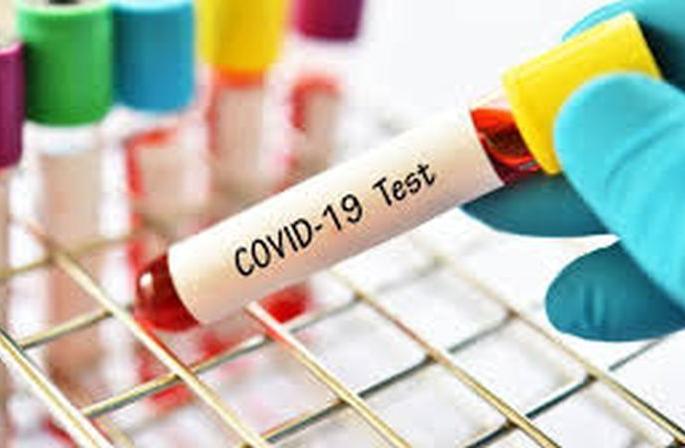 Another 124 corona positive in Washim district | वाशिम जिल्ह्यात आणखी १२४ कोरोना पाॅझिटिव्ह Another 124 corona positive in Washim district | वाशिम जिल्ह्यात आणखी १२४ कोरोना पाॅझिटिव्ह