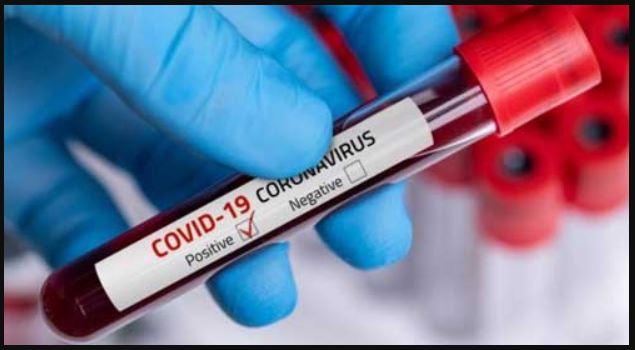 Corona virus in Nagpur: 10 patients tested positive in Nagpur, one died | CoronaVirus in Nagpur : नागपुरात ३१ रुग्ण पॉझिटिव्ह, एकाचा मृत्यू