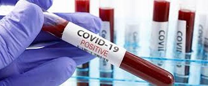 Another 105 corona positive patients in Akola district | अकोला जिल्ह्यात आणखी १०५ कोरोना पॉझिटिव्ह रुग्णांची भर Another 105 corona positive patients in Akola district | अकोला जिल्ह्यात आणखी १०५ कोरोना पॉझिटिव्ह रुग्णांची भर