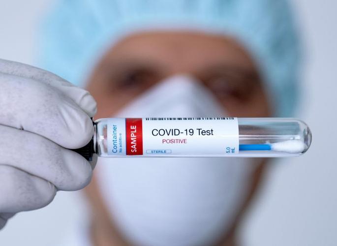 Corona Virus in Nagpur: 90% of patients overcome corona in Nagpur | CoronaVirus in Nagpur : नागपुरात ९० टक्के रुग्णांची कोरोनावर मात Corona Virus in Nagpur: 90% of patients overcome corona in Nagpur | CoronaVirus in Nagpur : नागपुरात ९० टक्के रुग्णांची कोरोनावर मात