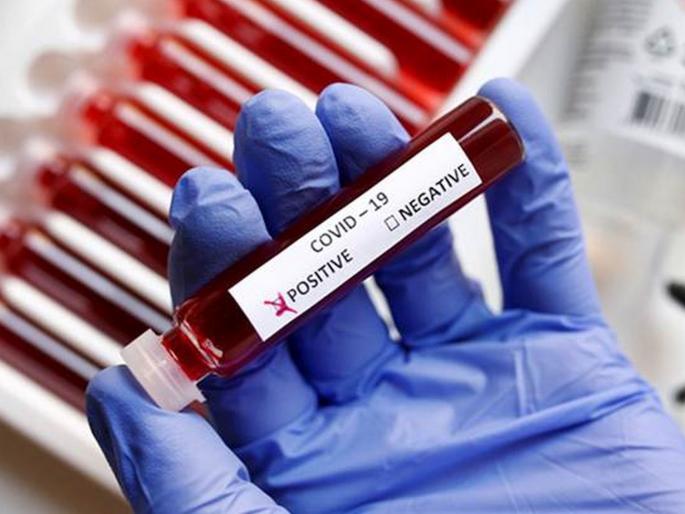 Man flies from Delhi to Kolkata via Guwahati with COVID positive report in his pocket | CoronaVirus News: कोरोना रिपोर्ट खिशात अन् दिल्ली ते कोलकाता प्रवास; अनेकजण गॅसवर Man flies from Delhi to Kolkata via Guwahati with COVID positive report in his pocket | CoronaVirus News: कोरोना रिपोर्ट खिशात अन् दिल्ली ते कोलकाता प्रवास; अनेकजण गॅसवर