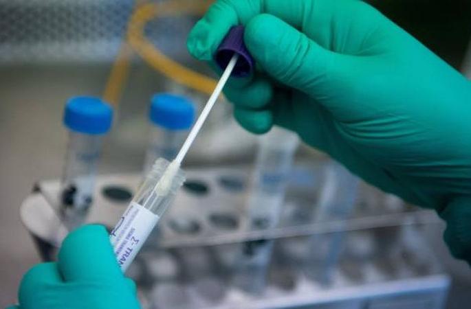 Corona is not affected in any of the 28 samples in Nagpur: 21 samples from Amravati | नागपुरात २८ नमुन्यातही कोणी कोरोना बाधित नाही : अमरावतीमधून आले २१ नमुने Corona is not affected in any of the 28 samples in Nagpur: 21 samples from Amravati | नागपुरात २८ नमुन्यातही कोणी कोरोना बाधित नाही : अमरावतीमधून आले २१ नमुने
