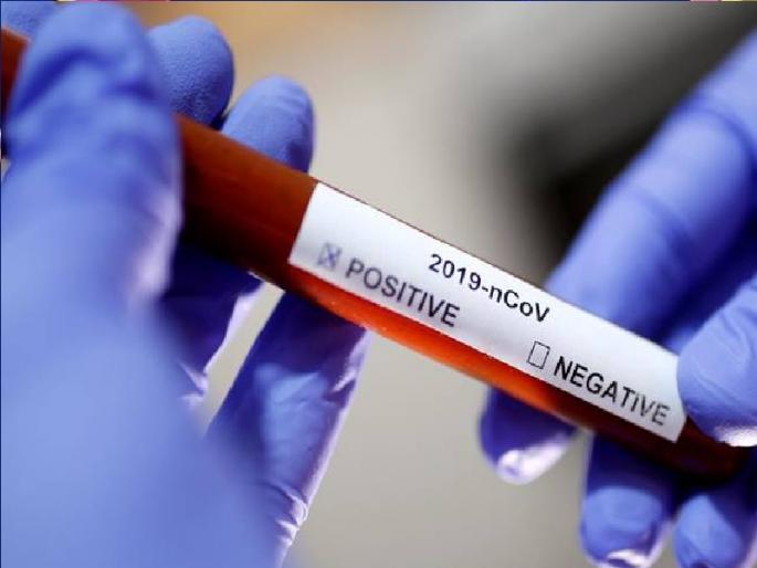 Suspected Negative in Sangli from Africa | हुश् ऽऽ, आफ्रिकेतून सांगलीत आलेला संशयित निगेटिव्ह Suspected Negative in Sangli from Africa | हुश् ऽऽ, आफ्रिकेतून सांगलीत आलेला संशयित निगेटिव्ह