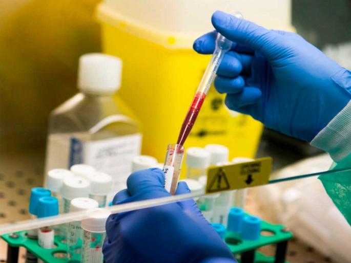 coronavirus: Sero survey in the city from August 10 | coronavirus : १० ऑगस्टपासून शहरात सेरो सर्वेक्षण; ४ हजार पेक्षा जास्त नमुनांची होणार तपासणी