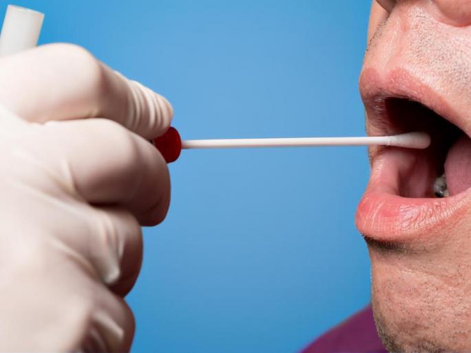 Dental, Ayurveda doctors help to get swab in Nagpur | नागपुरात स्वॅब घेण्यास डेंटल, आयुर्वेद डॉक्टरांची मदत Dental, Ayurveda doctors help to get swab in Nagpur | नागपुरात स्वॅब घेण्यास डेंटल, आयुर्वेद डॉक्टरांची मदत