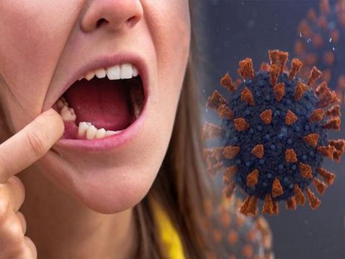 CoronaVirus covid 19 survivors facing odd symptom of teeth falling out after being recovered | CoronaVirus News: कोरोनामुक्त झालेल्यांचे दात पडू लागल्यानं चिंतेत वाढ; डॉक्टरांसह सगळेच हैराण CoronaVirus covid 19 survivors facing odd symptom of teeth falling out after being recovered | CoronaVirus News: कोरोनामुक्त झालेल्यांचे दात पडू लागल्यानं चिंतेत वाढ; डॉक्टरांसह सगळेच हैराण