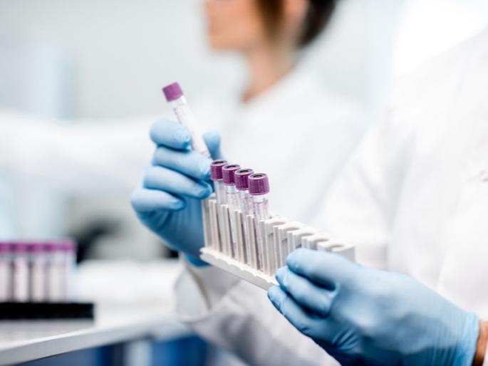Corona virus: 1 thousand 621 corona infections increased on friday in Pune city ; 62 people died | Corona virus : पुणे शहरात शुक्रवारी १ हजार ६२१ कोरोनाबाधितांची वाढ ; ६२ जणांचा मृत्यू Corona virus: 1 thousand 621 corona infections increased on friday in Pune city ; 62 people died | Corona virus : पुणे शहरात शुक्रवारी १ हजार ६२१ कोरोनाबाधितांची वाढ ; ६२ जणांचा मृत्यू