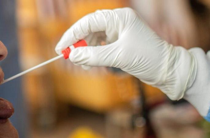 High Court: Doctors from all over Vidarbha, test the corona of the police | हायकोर्ट : संपूर्ण विदर्भातील डॉक्टर, पोलिसांची कोरोना चाचणी करा High Court: Doctors from all over Vidarbha, test the corona of the police | हायकोर्ट : संपूर्ण विदर्भातील डॉक्टर, पोलिसांची कोरोना चाचणी करा