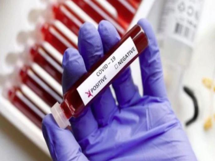 coronavirus: Improved emergency patient will be tested before discharge | coronavirus: सुधारलेल्या अत्यवस्थ रुग्णाची होणार डिस्चार्जपूर्वी चाचणी