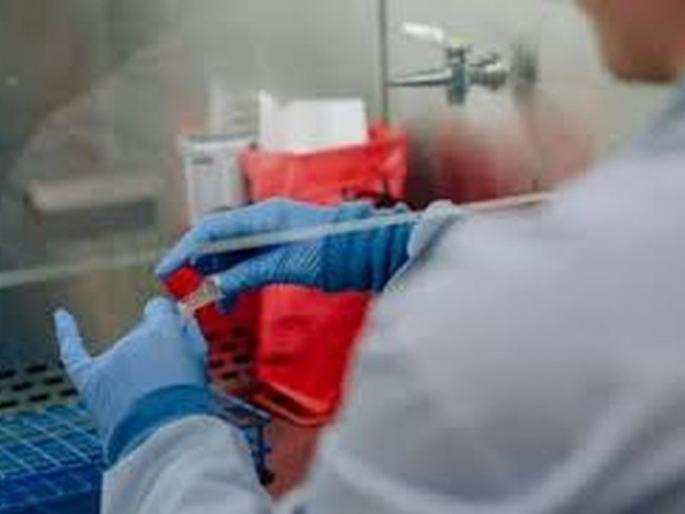 Corona test started without permission from lab in Akola! | अकोल्यातील खासगी लॅबकडून विनापरवानगी सुरू होती कोरोना चाचणी! Corona test started without permission from lab in Akola! | अकोल्यातील खासगी लॅबकडून विनापरवानगी सुरू होती कोरोना चाचणी!