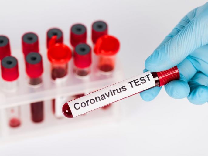 Good News: In Solapur Grameen, 90 per cent people tested negative in 21,000 tests | Good News: सोलापूर ग्रामीणमध्ये २१ हजार चाचण्यात ९0 टक्के लोक निगेटिव्ह Good News: In Solapur Grameen, 90 per cent people tested negative in 21,000 tests | Good News: सोलापूर ग्रामीणमध्ये २१ हजार चाचण्यात ९0 टक्के लोक निगेटिव्ह