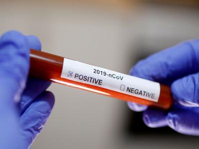 Corona positive found in Washim district | कोरोनाचा वाशिममध्ये शिरकाव; दिल्लीच्या कार्यक्रमातील सहभागीचा अहवाल पॉझिटिव्ह Corona positive found in Washim district | कोरोनाचा वाशिममध्ये शिरकाव; दिल्लीच्या कार्यक्रमातील सहभागीचा अहवाल पॉझिटिव्ह