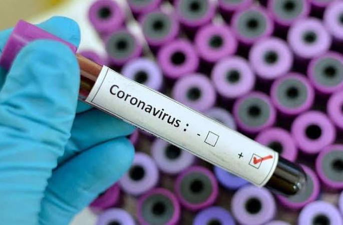corona virus : Corona's positive patient in Aurangabad; Professor Woman's Corona Report 'Positive' | corona virus : औरंगाबादेत कोरोनाचा शिरकाव; प्राध्यापक महिलेचा कोरोना अहवाल ‘पॉझिटिव्ह’ corona virus : Corona's positive patient in Aurangabad; Professor Woman's Corona Report 'Positive' | corona virus : औरंगाबादेत कोरोनाचा शिरकाव; प्राध्यापक महिलेचा कोरोना अहवाल ‘पॉझिटिव्ह’
