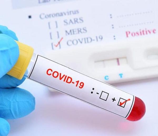 24 new patients registered in Vidarbha; The number of corona patients crossed the 400 mark | विदर्भात २४ नव्या रुग्णांची नोंद; कोरोना रुग्ण संख्येने ४०० चा टप्पा ओलांडला