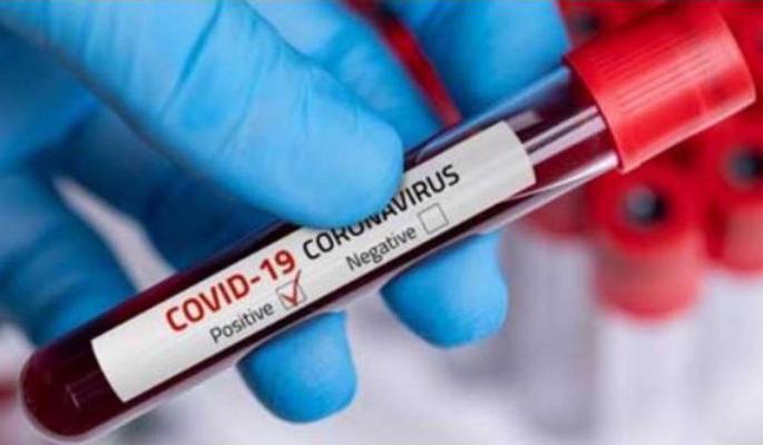Corona Virus in Nagpur: 71 patients tested positive in Nagpur, one died: Rise in rural areas | CoronaVirus in Nagpur : नागपुरात ७१ रुग्ण पॉझिटिव्ह, एकाचा मृत्यू : ग्रामीण भागातही वाढ Corona Virus in Nagpur: 71 patients tested positive in Nagpur, one died: Rise in rural areas | CoronaVirus in Nagpur : नागपुरात ७१ रुग्ण पॉझिटिव्ह, एकाचा मृत्यू : ग्रामीण भागातही वाढ