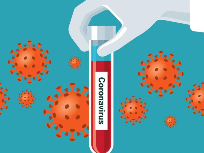 Another 55 corona positive patients were found in Akola district | अकोला जिल्ह्यात आणखी ५५ कोरोना पॉझिटिव्ह रुग्ण आढळले Another 55 corona positive patients were found in Akola district | अकोला जिल्ह्यात आणखी ५५ कोरोना पॉझिटिव्ह रुग्ण आढळले