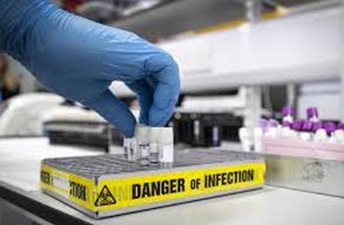 CoronaVirus: 'Corona' test to be held in Akola! | CoronaVirus : अकोल्यातच होणार ‘कोरोना’ची तपासणी!