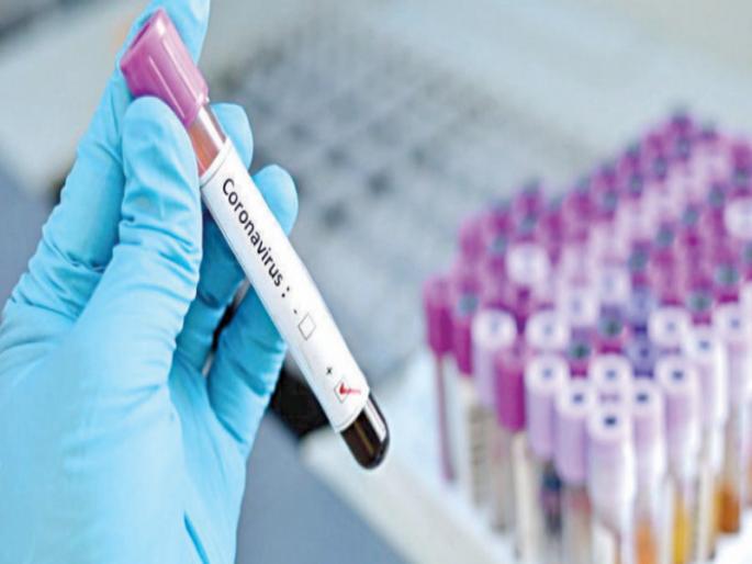 Corona virus : Administration employees who fight with Corona got infected In Purandar taluka | Corona virus : पुरंदर तालुक्यात कोरोनाशी लढा देणाऱ्या प्रशासनातील कर्मचाऱ्यालाच संसर्ग झाल्याने खळबळ