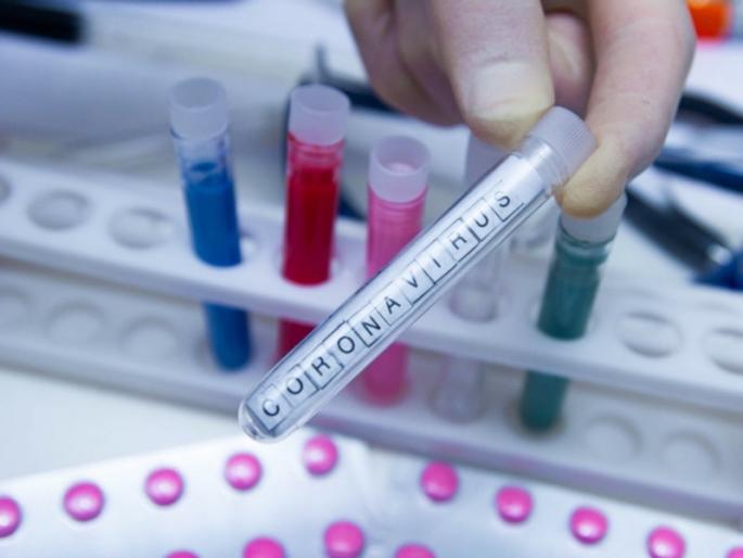 Corona virus :Pune Municipal Corporation to issue notice to private lab; Failure to provide timely information | Corona virus : पुणे महापालिका खासगी लॅबला देणार नोटिसा; वेळेत माहिती देण्यात कुचराई Corona virus :Pune Municipal Corporation to issue notice to private lab; Failure to provide timely information | Corona virus : पुणे महापालिका खासगी लॅबला देणार नोटिसा; वेळेत माहिती देण्यात कुचराई