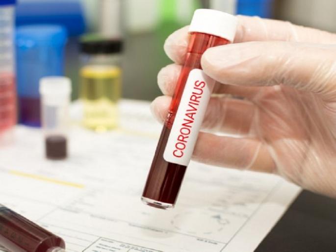 coronavirus: Aurangabad crosses thirteen hundred patient mark; Addition of 16 positive cases, infiltration of new areas | coronavirus : औरंगाबाद तेराशे पार; १६ बाधितांची भर, नव्या भागात शिरकाव coronavirus: Aurangabad crosses thirteen hundred patient mark; Addition of 16 positive cases, infiltration of new areas | coronavirus : औरंगाबाद तेराशे पार; १६ बाधितांची भर, नव्या भागात शिरकाव