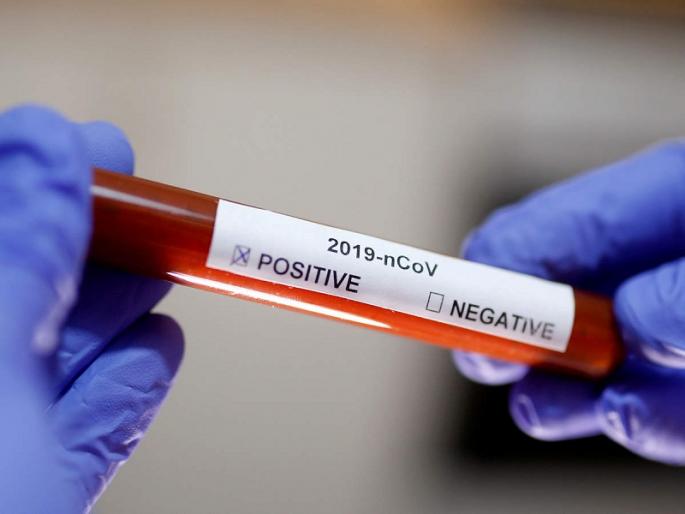 coronavirus: जालना @ 71; 10 people found corona positive including 5 employees of a private hospital | coronavirus : जालना @ ७१; खाजगी रुग्णालयातील ५ कर्मचाऱ्यांसह १० जण बाधित