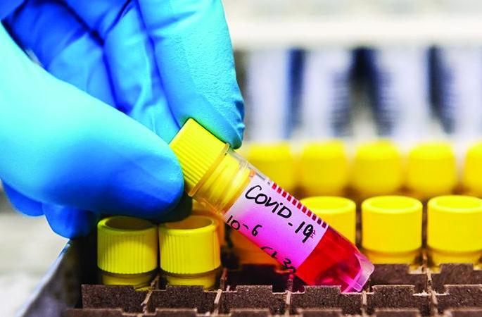 CoronaVirus in Maharashtra: Every day, Corona patients are on the rise across the state | CoronaVirus in Maharashtra : राज्यभरात रोज वाढताहेत २०० वर 'कोरोना' रुग्ण