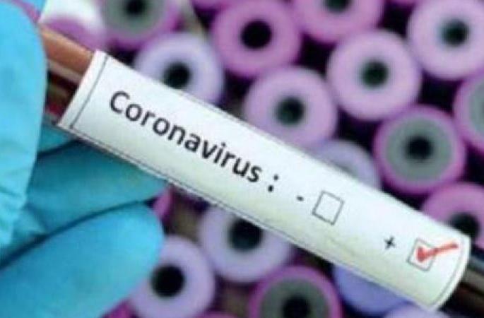 In Nagpur, 24 patients including nurses tested positive, 583 patients | CoronaVirus in Nagpur : नागपुरात परिचारिकेसह २४ रुग्ण पॉझिटिव्ह, रुग्णसंख्या ५८३ In Nagpur, 24 patients including nurses tested positive, 583 patients | CoronaVirus in Nagpur : नागपुरात परिचारिकेसह २४ रुग्ण पॉझिटिव्ह, रुग्णसंख्या ५८३