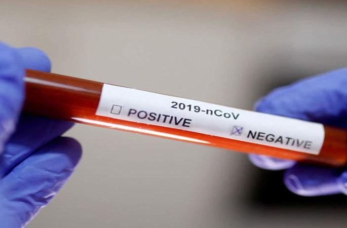 Three young women become corona infection did viral, offence registered | तीन तरुणींना कोरोना संसर्ग झाल्याचे केले व्हायरल,गुन्हा दाखल Three young women become corona infection did viral, offence registered | तीन तरुणींना कोरोना संसर्ग झाल्याचे केले व्हायरल,गुन्हा दाखल