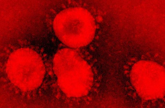 Corona's first victim in Vidarbha; The number of patients in Vidarbha has reached 90 | Corona Virus in Nagpur; विदर्भात कोरोनाचा पहिला बळी