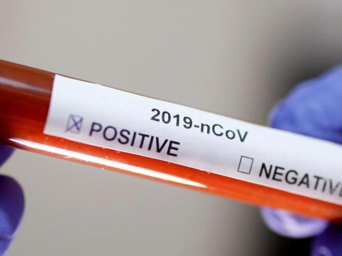 CoronaVirus: Three suspected patients report negative; 10 reports pending | CoronaVirus : तीन संदिग्ध रुग्णांचे अहवाल निगेटिव्ह; १० अहवाल प्रलंबित CoronaVirus: Three suspected patients report negative; 10 reports pending | CoronaVirus : तीन संदिग्ध रुग्णांचे अहवाल निगेटिव्ह; १० अहवाल प्रलंबित