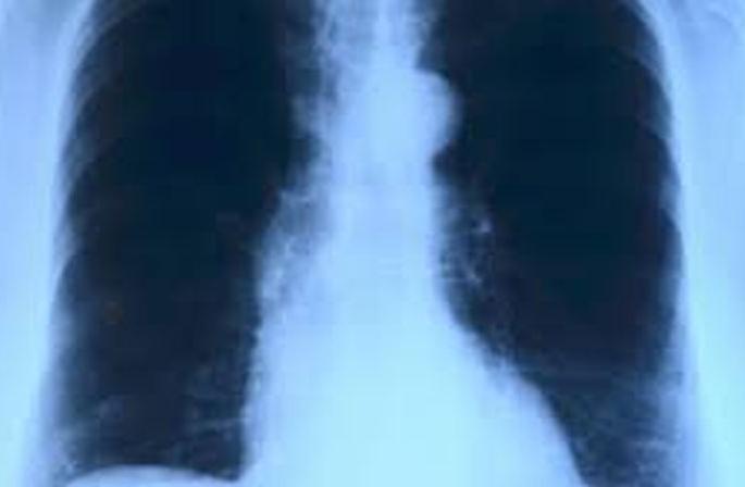 Corona positive patient waiting for X-ray for four hours! | कोरोना पॉझिटिव्ह रुग्ण चार तास ‘एक्स-रे’साठी वेटिंगवर!