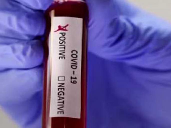 Sale of fake Corona report for just Rs 1000 in mumbai | CoronaVirus Fraud: अवघ्या हजार रुपयांत बनावट कोरोना अहवालाची विक्री Sale of fake Corona report for just Rs 1000 in mumbai | CoronaVirus Fraud: अवघ्या हजार रुपयांत बनावट कोरोना अहवालाची विक्री